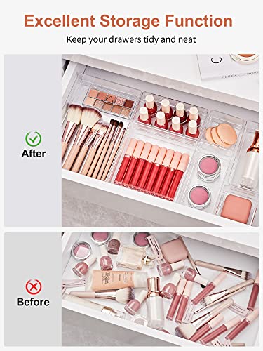 13 PCS Drawer Organizer 5-Size Desk Makeup Drawer Organizer Clear - view 4