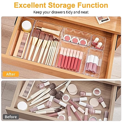13-Piece Drawer Organizers with Non-Slip Silicone Pads, 5-Size - view 4